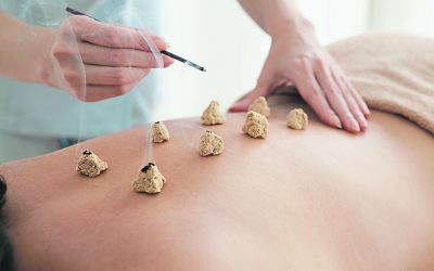 Corso di Moxa a Torino